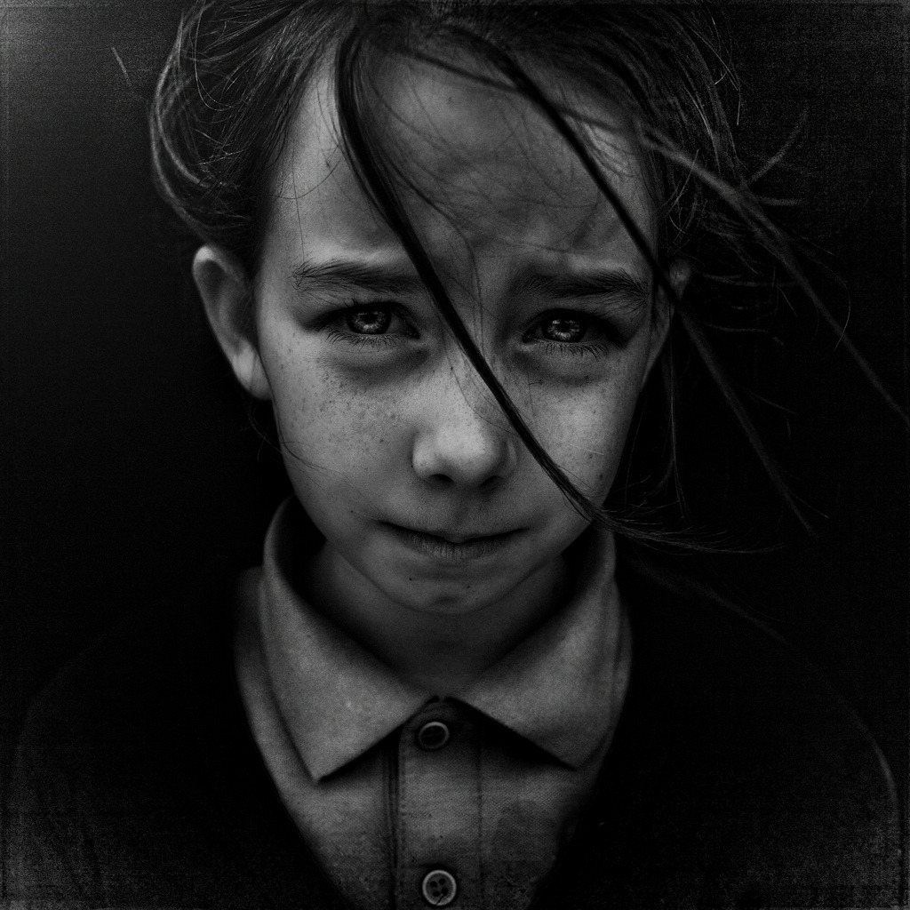 hidden-scars-slider7